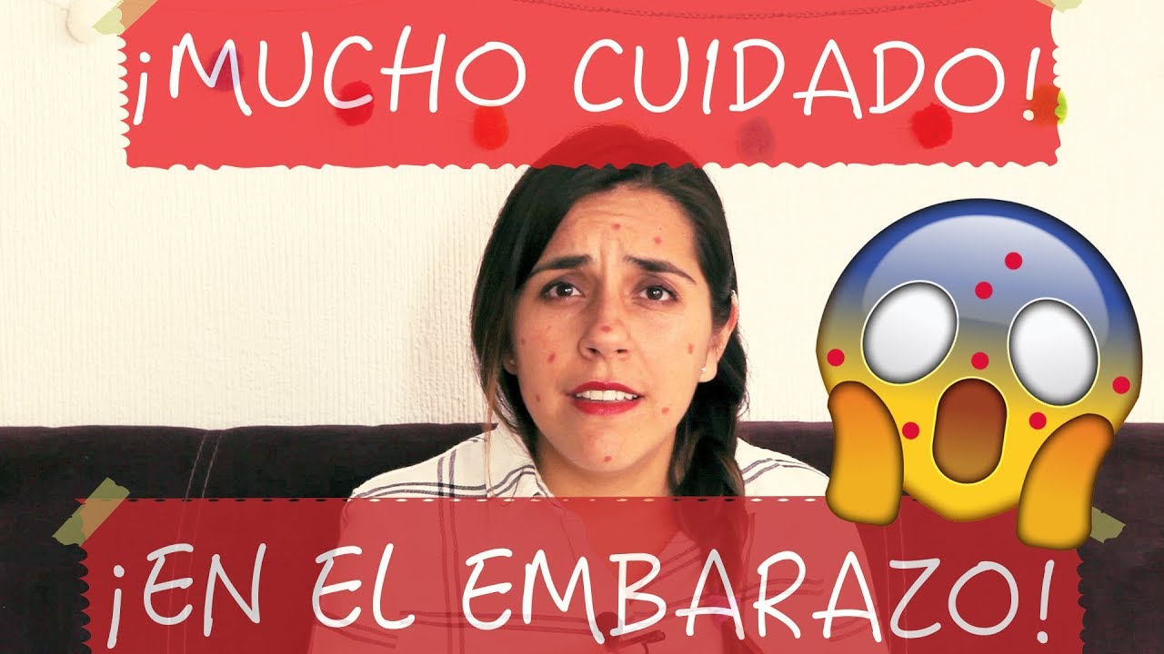 ¡Porqué la varicela es peligrosa en el embarazo!