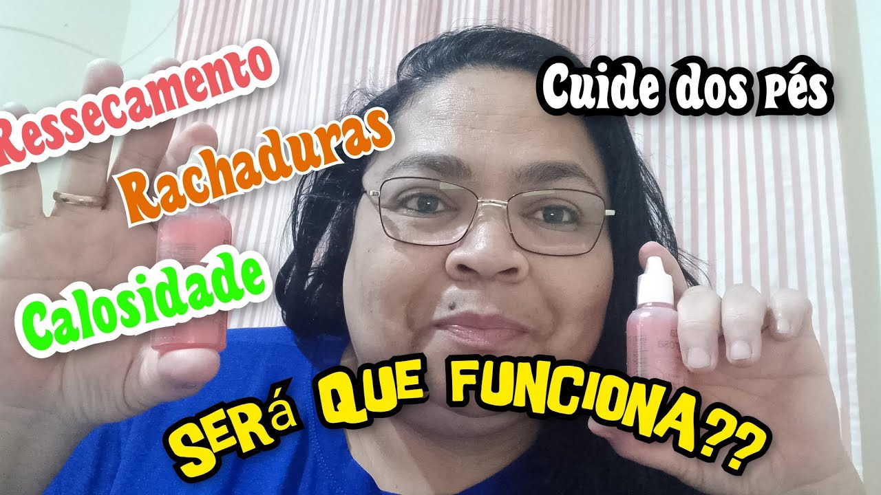 COMO CUIDAR DOS PÉS COM RACHADURAS, RESSECAMENTO E CALOSIDADE? GOTA MILAGROSA RESOLVE?????