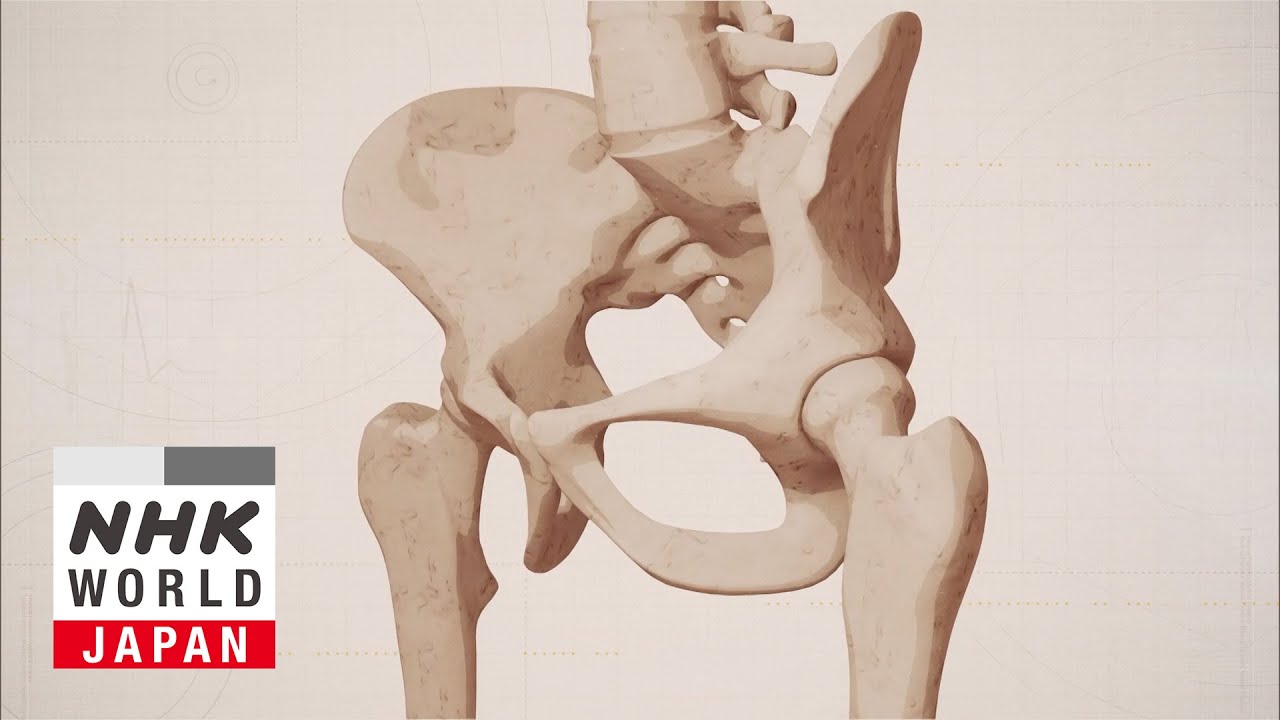 A Long-Lasting Artificial Hip Joint to Change Your Life - Medical Frontiers