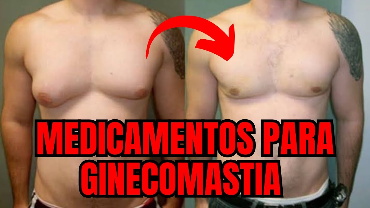 OS PRINCIPAIS MEDICAMENTOS USADOS PARA GINECOMASTIA