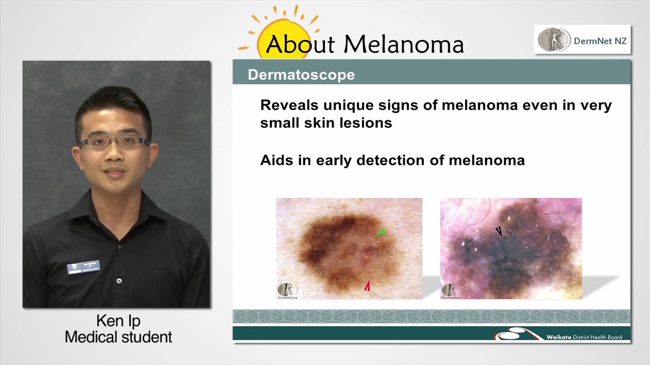 Dermatoscopy