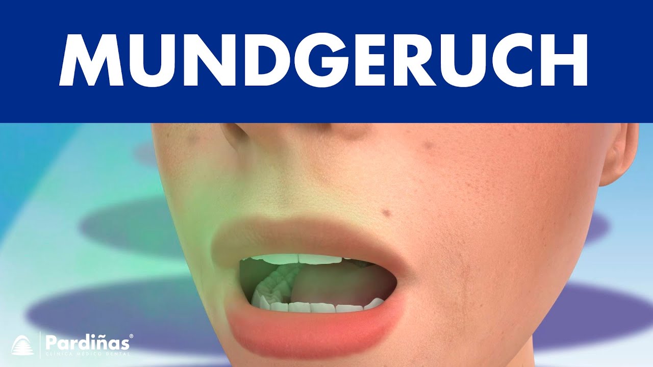 Mundgeruch &copy;