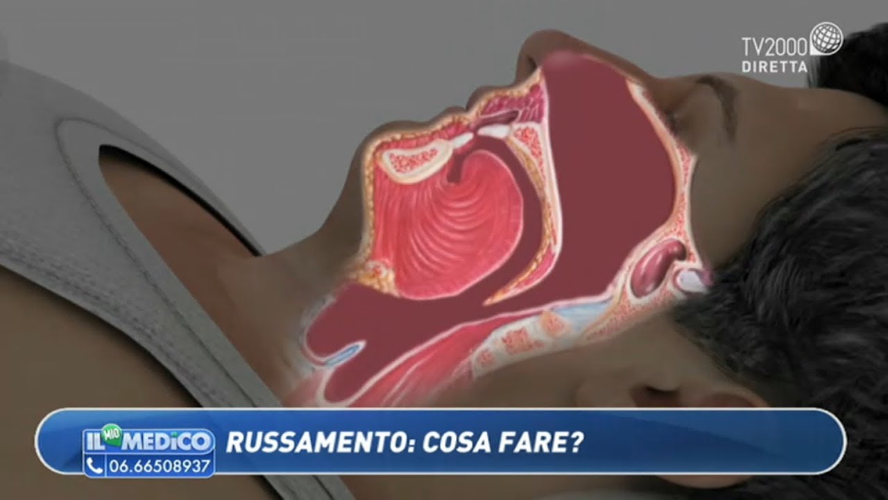 Il Mio Medico - Russamento: cosa fare?