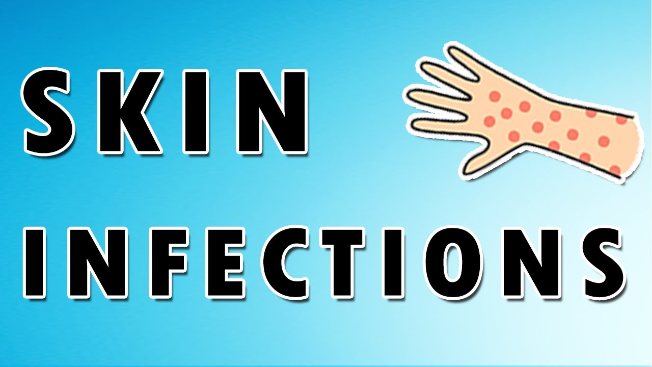 Common Skin Infections