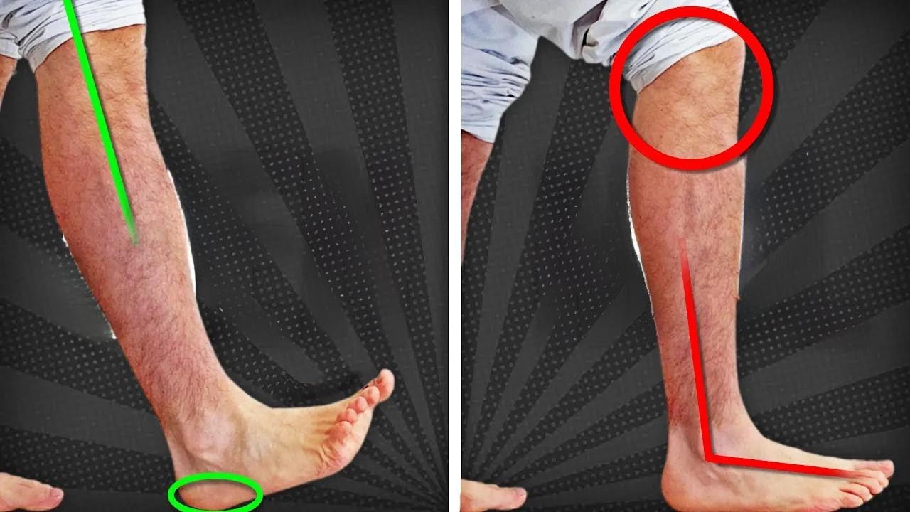 Fix Your Walk and Avoid Limping in 5 Minutes