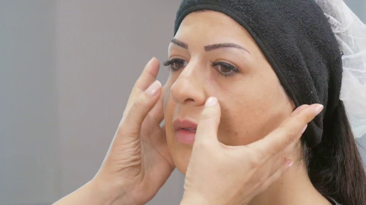 Volumation et contouring
