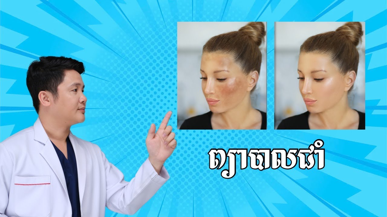 ការព្យាបាល និង ការពារជាំ​ កុំអោយកើតឡើងមកវិញ