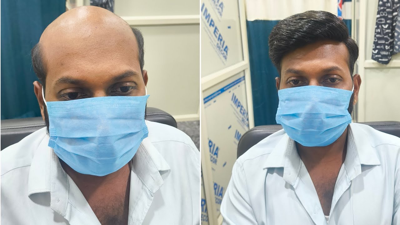 Hair patch  ଲଗାନ୍ତୁ  45 minutes ରେ new look ଫେରିପନ୍ତୁ//