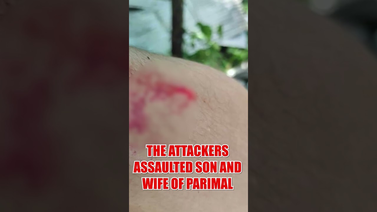 How BNP leaders assaulted a minority family to evict them from residence and occupy land in Ukhia