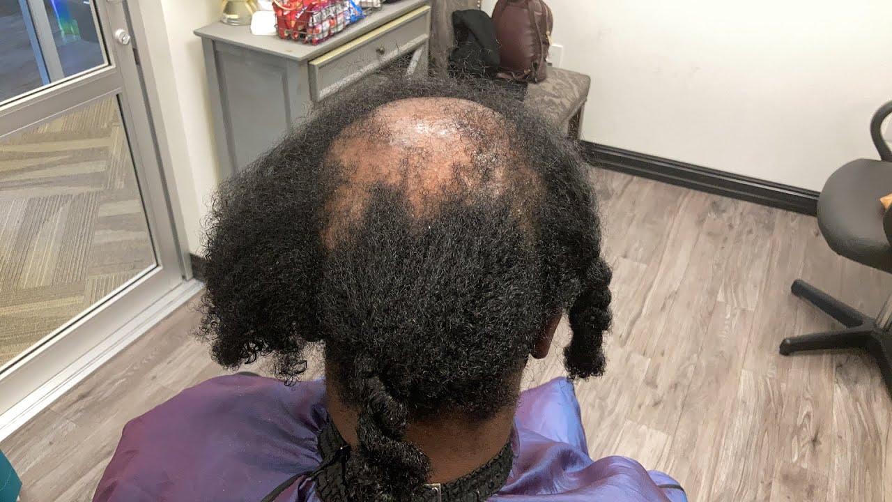 Invisible ponytail to hide my clients balding and thinning