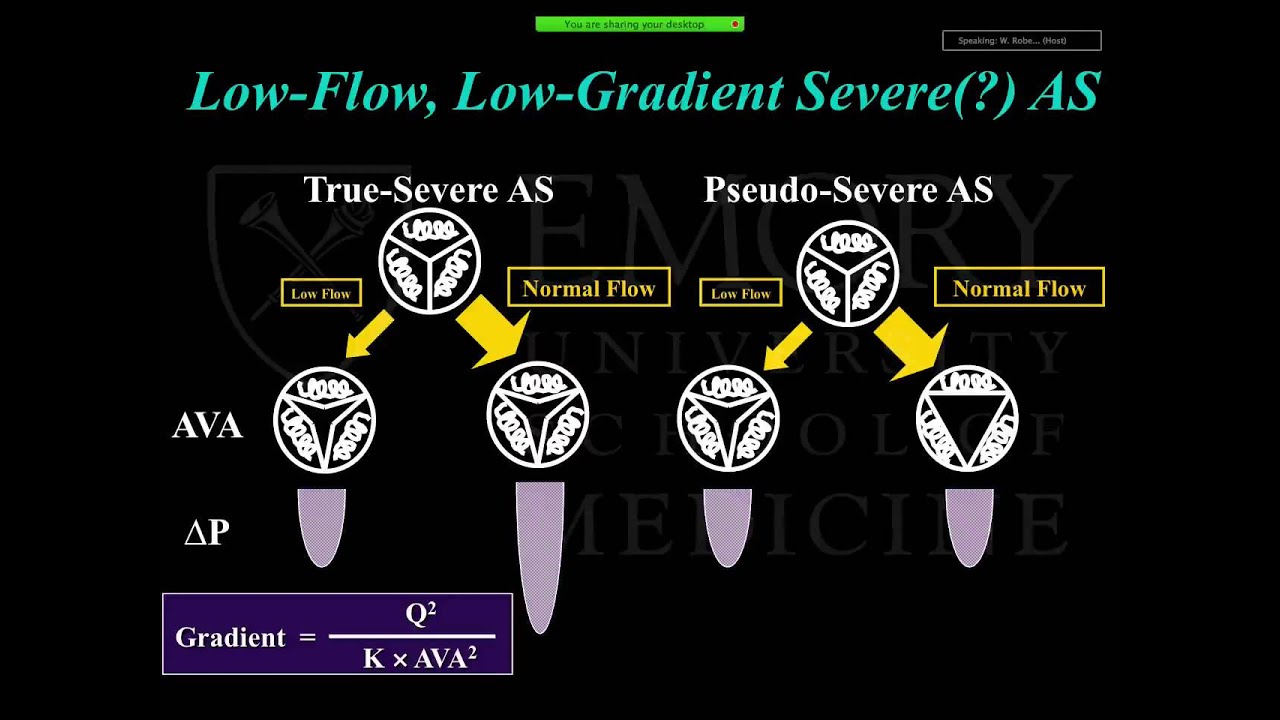 Emory Cardiology Grand Rounds 11-03-2014