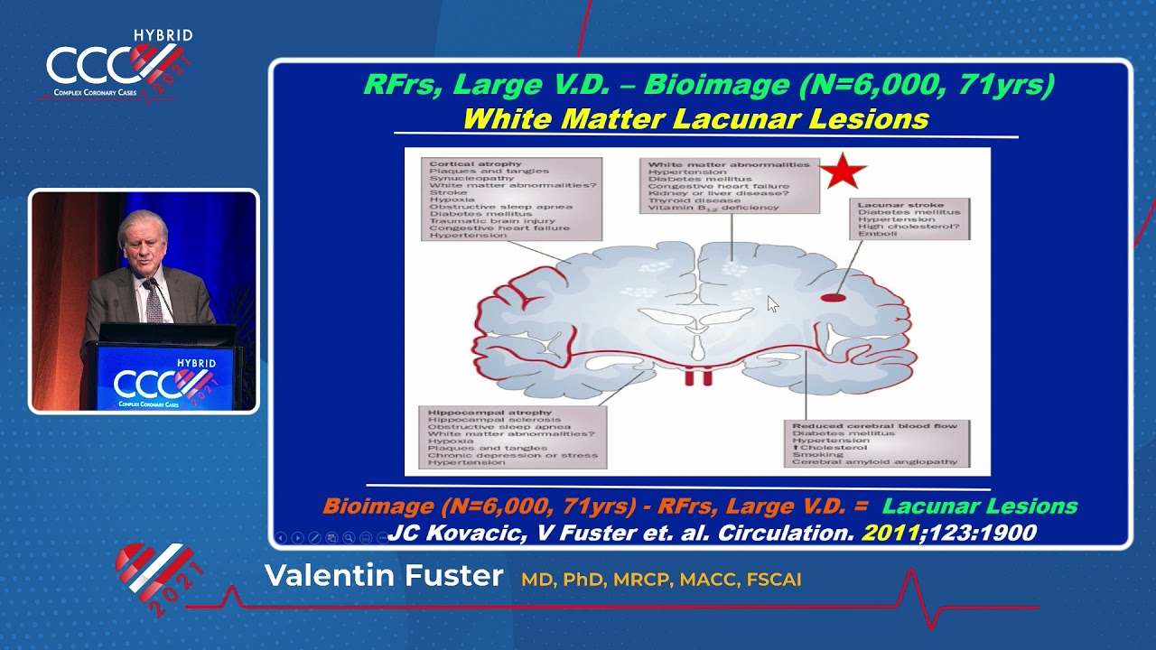 Systemic Atherosclerosis - Dr. Valentin Fuster