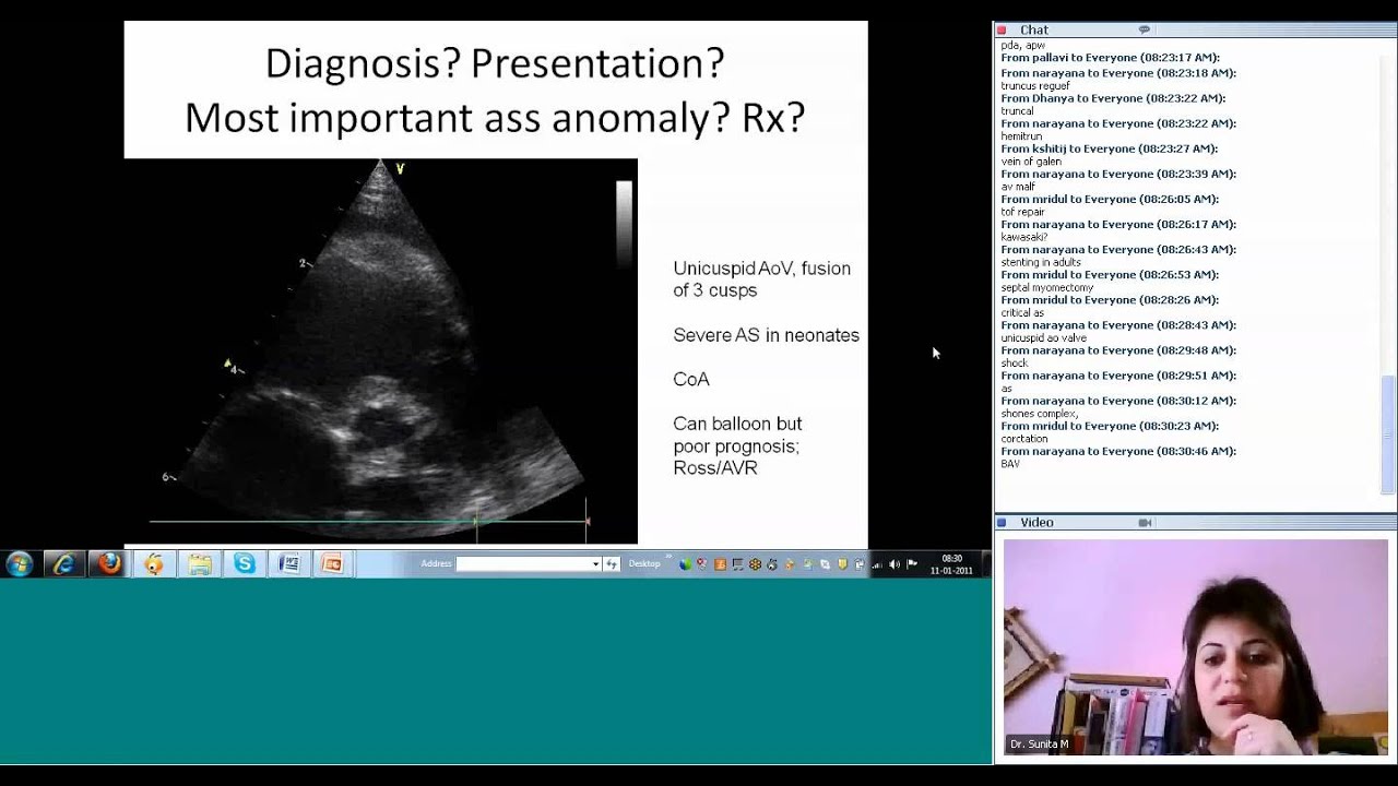 Pediatric Cardiology-Quiz by Dr Sunita Maheshwari