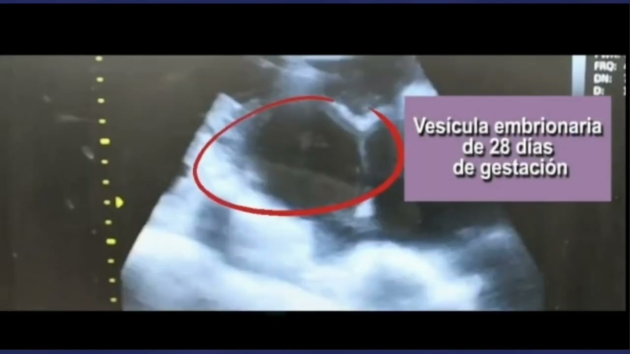 Diagnóstico de gestación por ultrasonido en cerdas