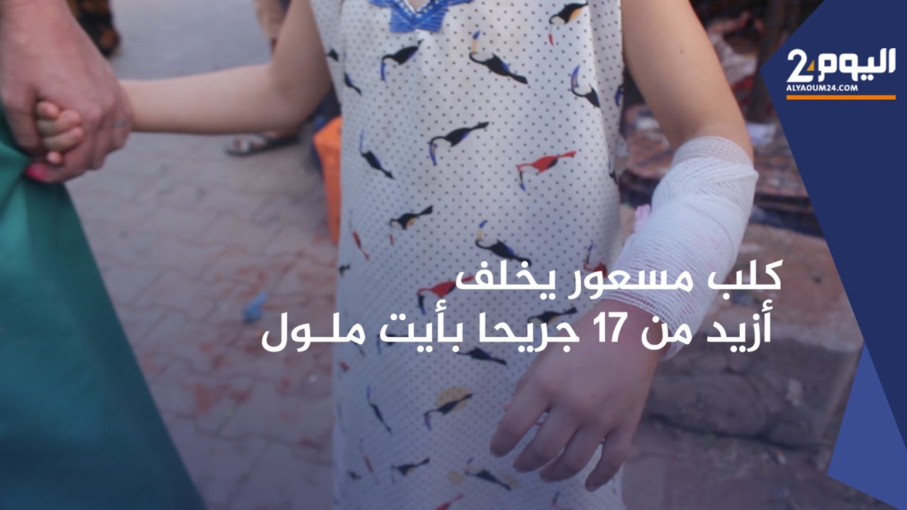كـلب مسعـور يخـلف أزيـد من 17 جريـحـاً من بينهم أطفـال بحي أزرو أيت ملول