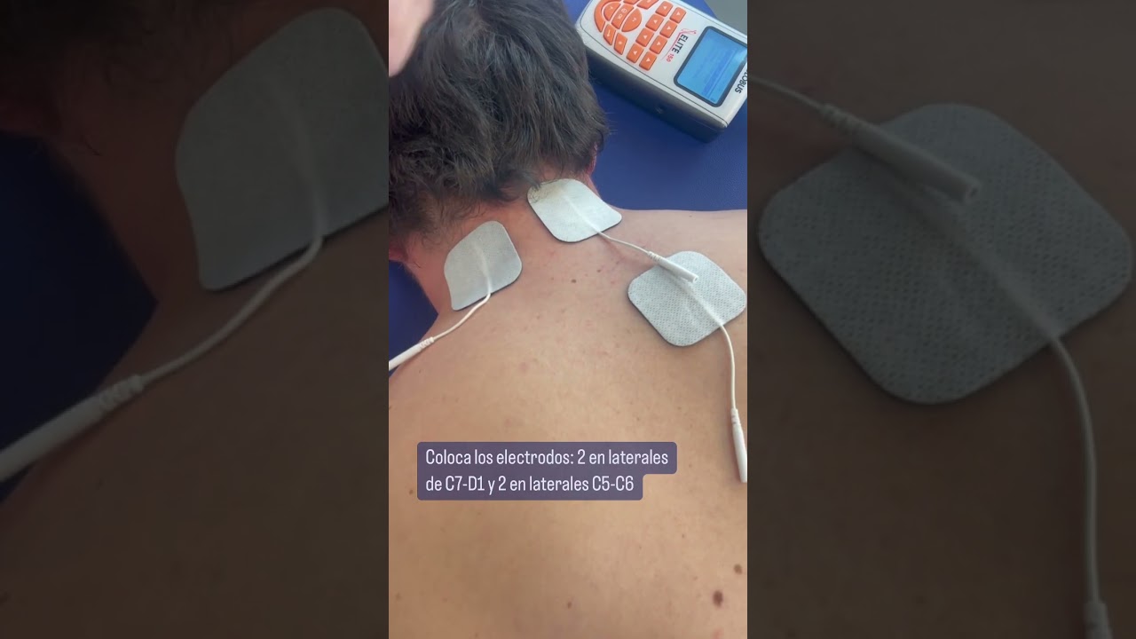 Como tratar el dolor cervical con electroestimulación ! 💥 
