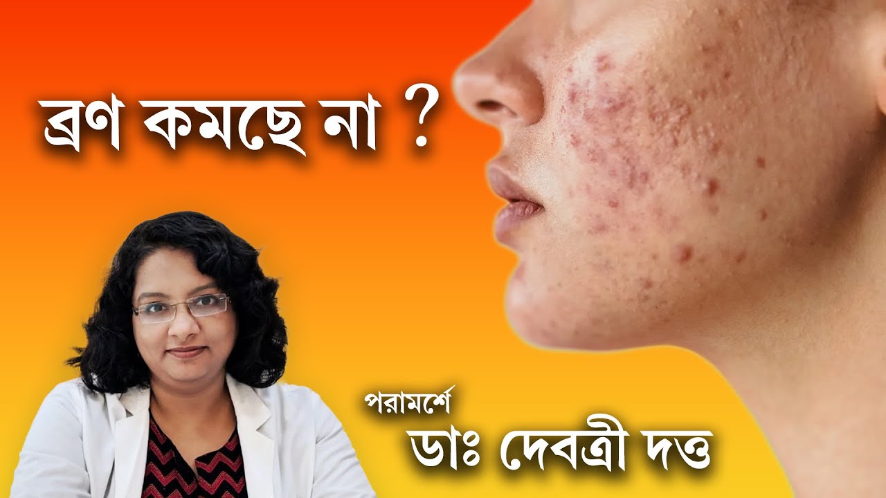 হরমোনাল ব্রণের জন্য কি করা উচিত? | PCOS & acne | Treatment-resistant acne | Dermatologist Advices