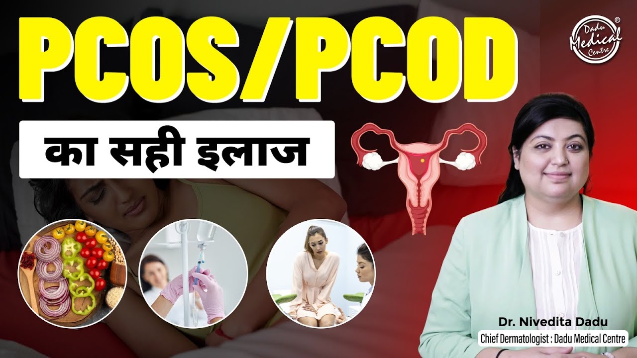 How To Cure PCOS/PCOD Problem Permanently | PCOS Causes & Treatment | Dadu Medical Centre