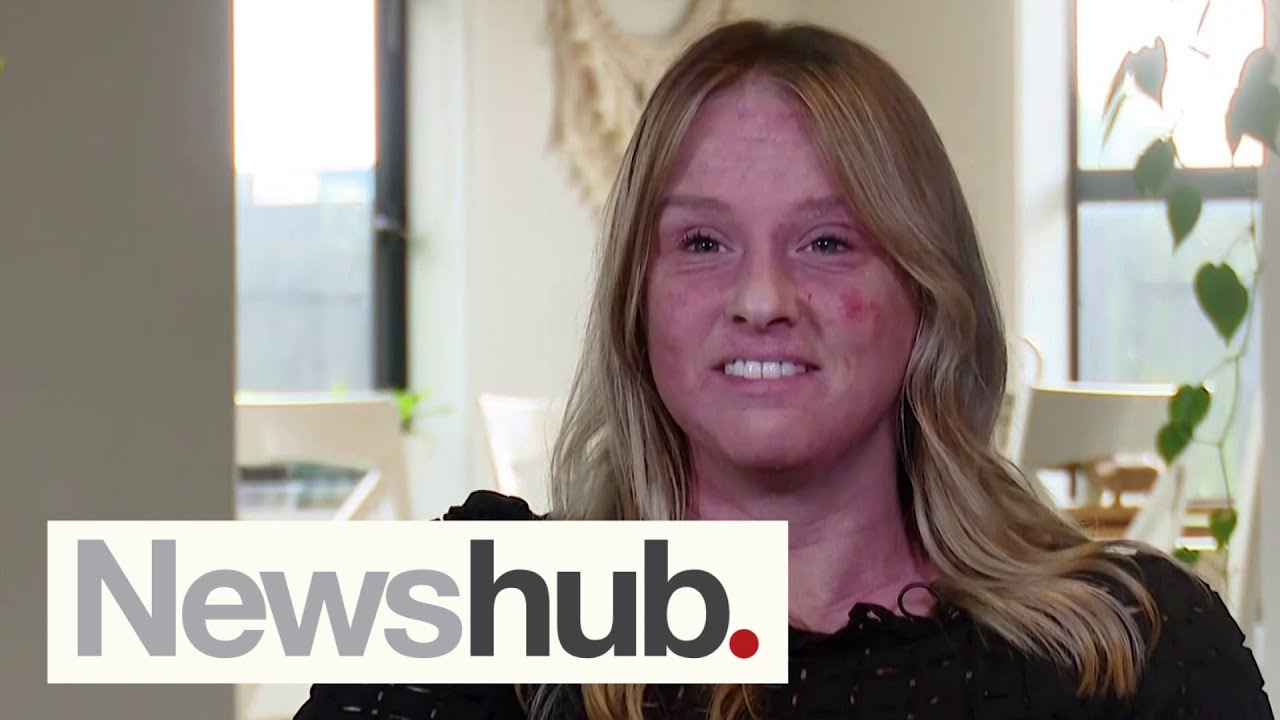 'Medication wrecked her life': How common topical eczema treatment led to addiction | Newshub