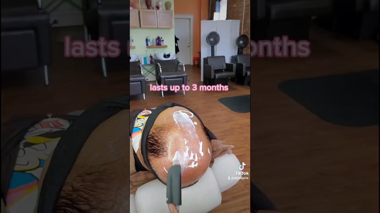 Balding Solution for Women | Non Surgical Hair Replacement