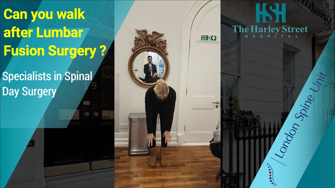 Can you walk after Lumbar Fusion Surgery ? ( London Spine Unit | Best UK Spinal Clinic )