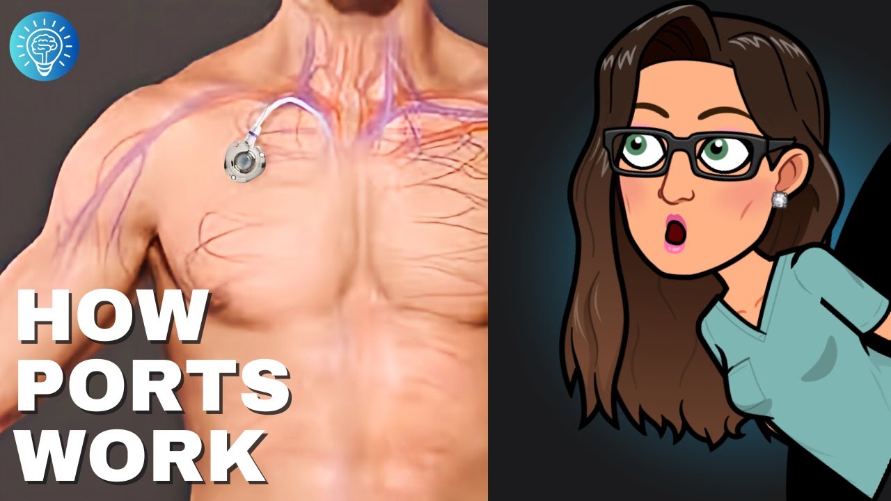 Implanted Port EXPERT Shares Top Tips for Beginners