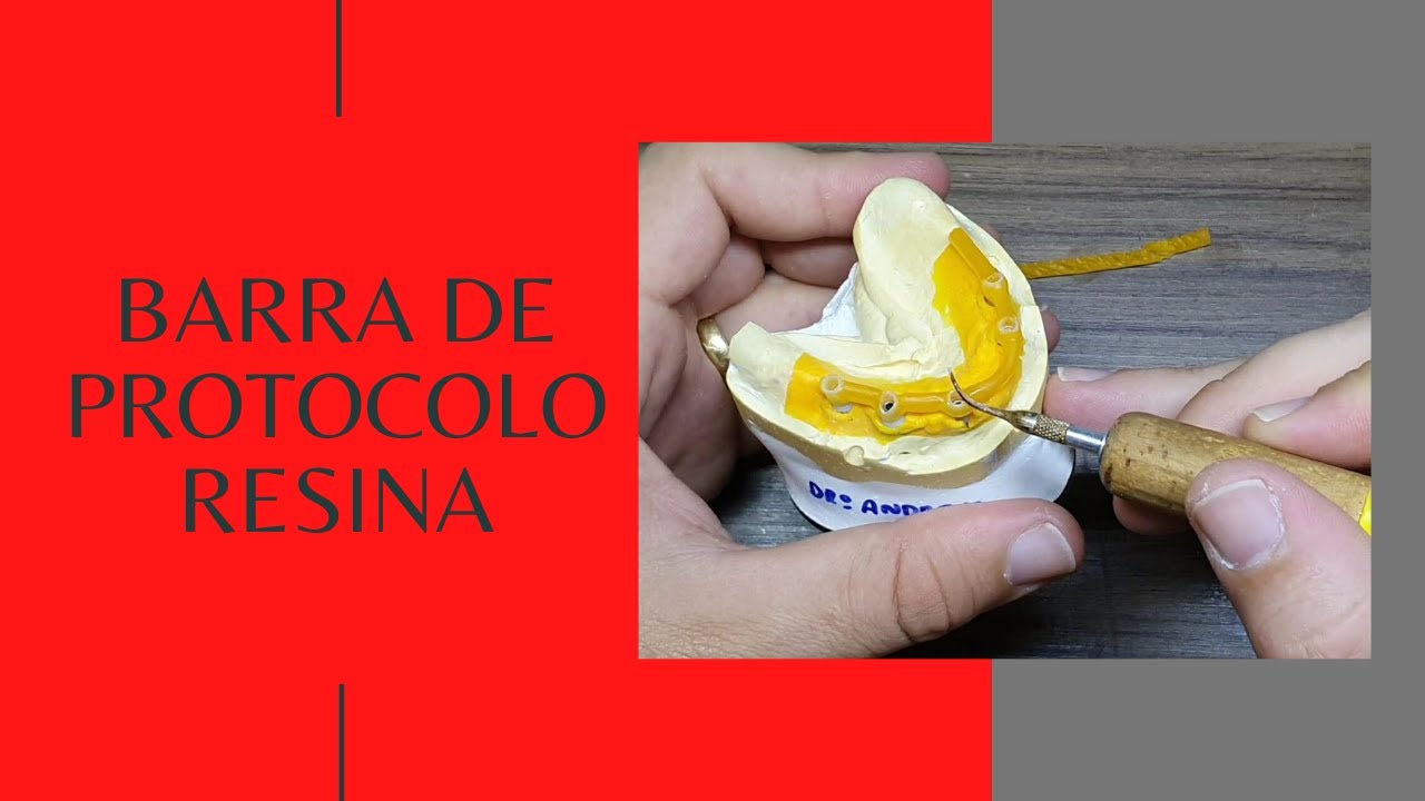 Confecção Barra de Protocolo Resina