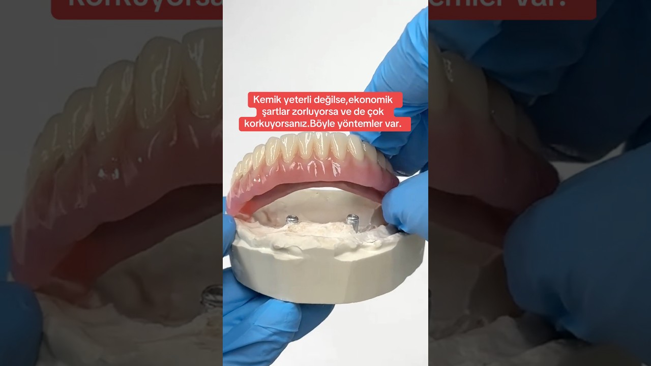 Diş olmayan üzülmesin 