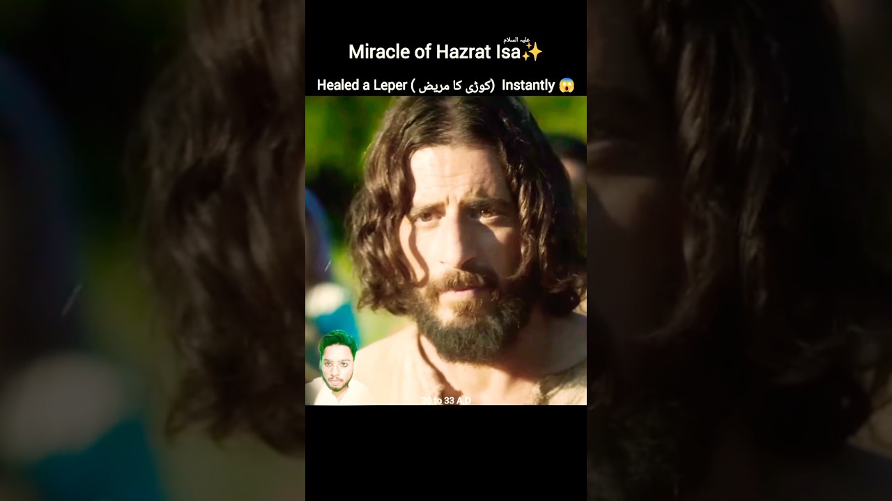 Miracle of Hazrat Isa ✨😱 Touched & Healed a Leper Instantly #hazratisa #jesus #miracleofallah