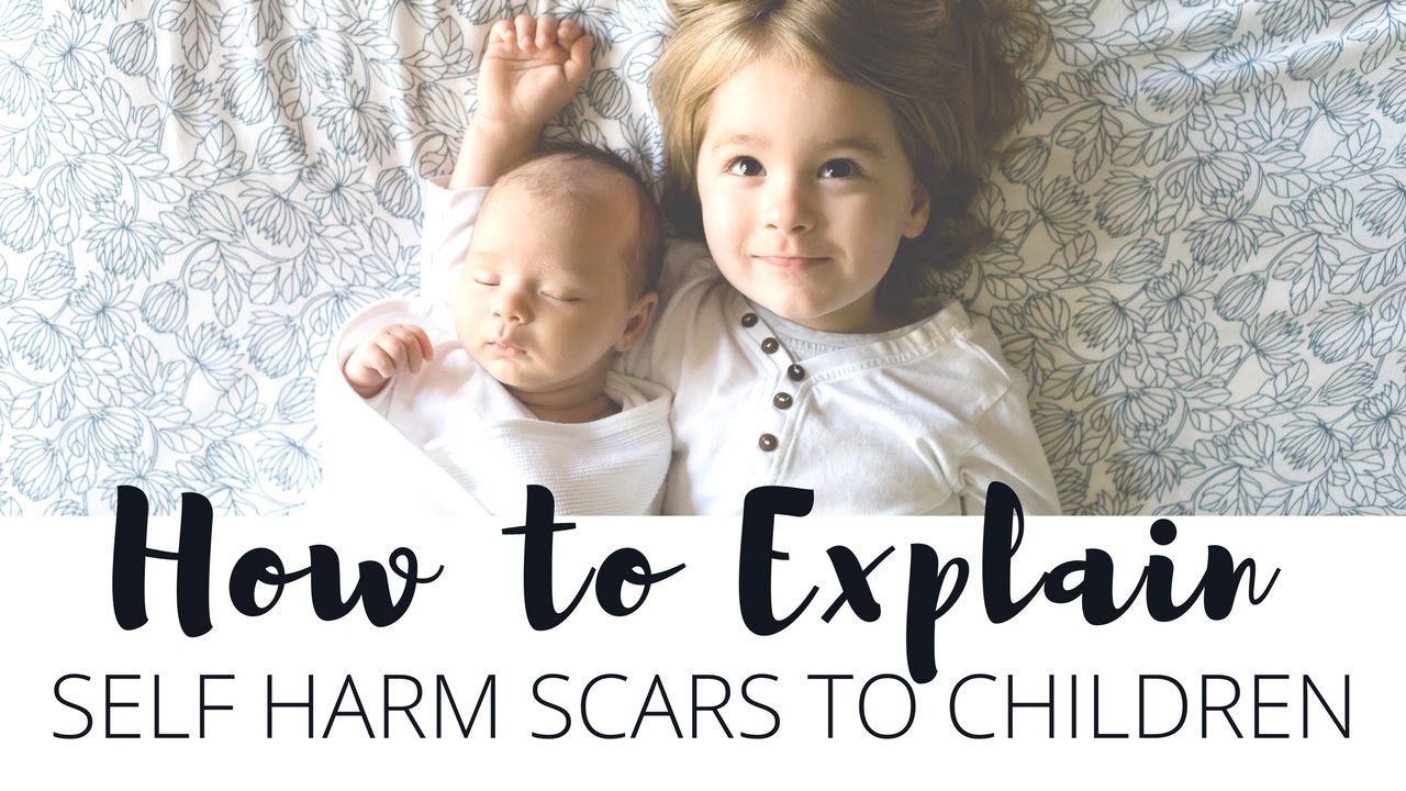 How To Explain Self Harm Scars To Children
