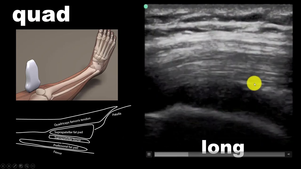 Introduction to Musculoskeletal Ultrasound