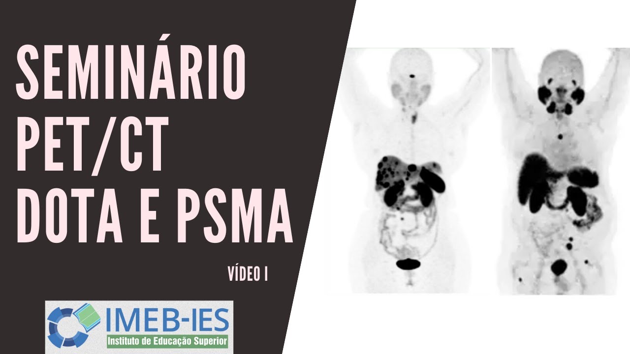 Seminário PET-CT DOTA-Gálio-68  | IMEB - IES