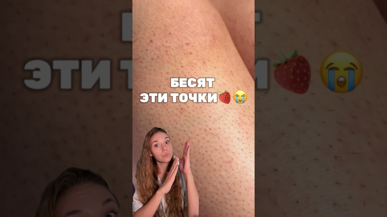 Топ-комбо против КЛУБНИЧНЫЙ КОЖИ: 
