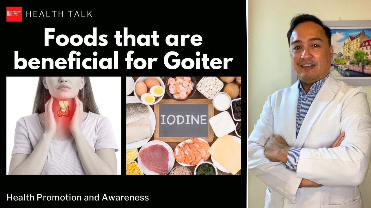 Foods na makakatulong sa pasyenteng may Goiter or bosyo