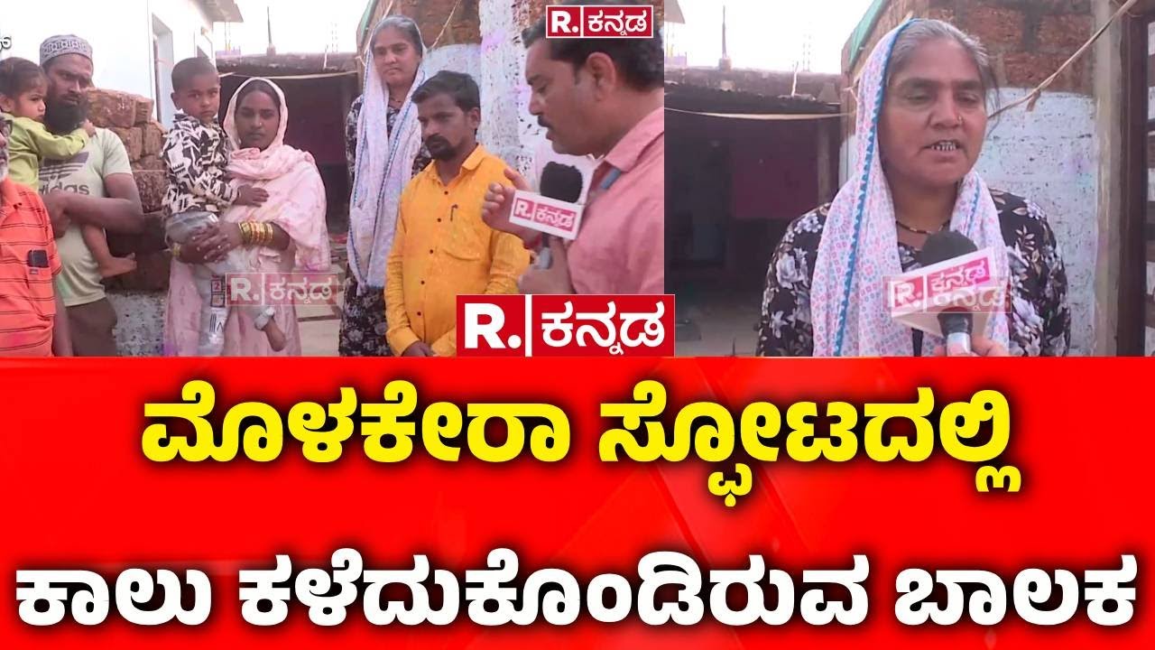 Massive Blast in Bidar | ಮೊಳಕೇರಾ ಸ್ಫೋಟದಲ್ಲಿ ಕಾಲು ಕಳೆದುಕೊಂಡಿರುವ ಬಾಲಕ