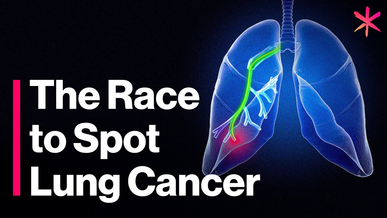 This Robot Creates a GPS for Your Lungs