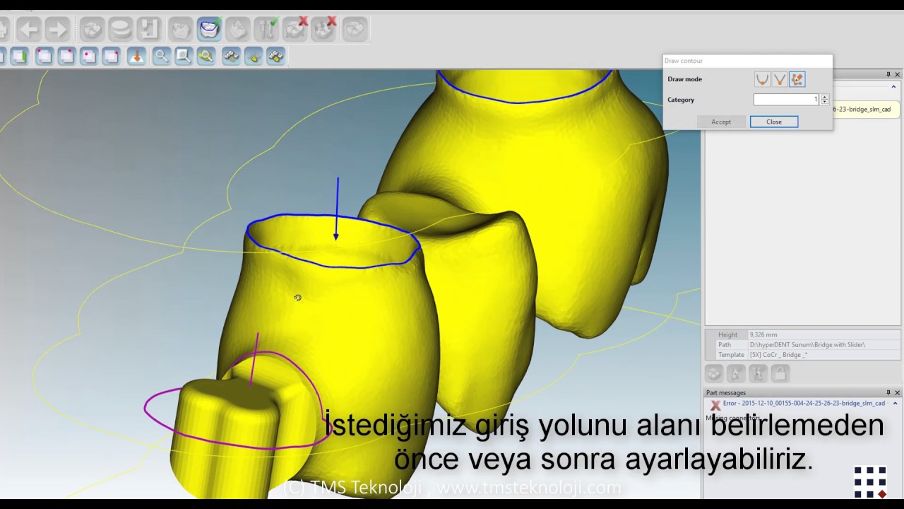 hyperDENT User Defined Areas