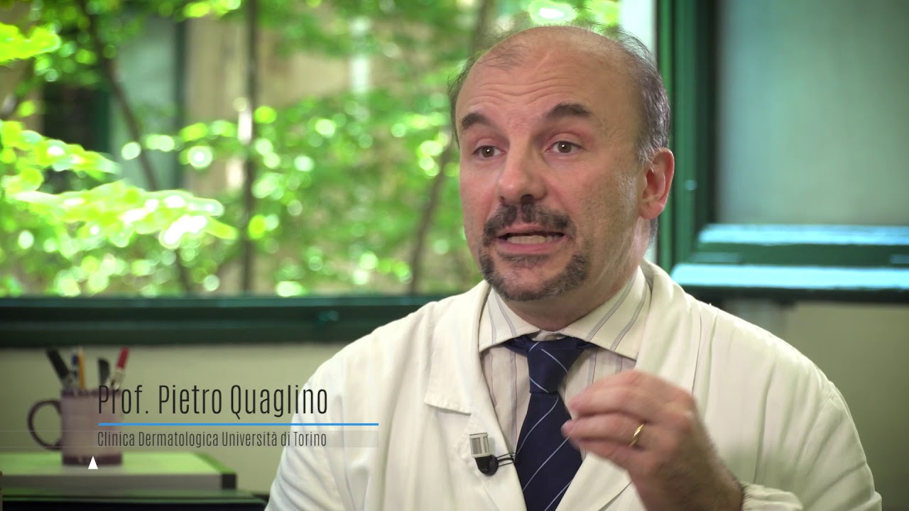 Carcinoma a cellule di Merkel, fondamentale il dermatologo per diagnosticare questo tumore raro