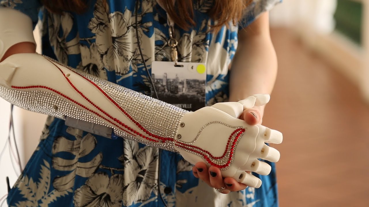 Open Bionics: UK startup creates custom fitted 3D printed bionic arm for less than £1,000