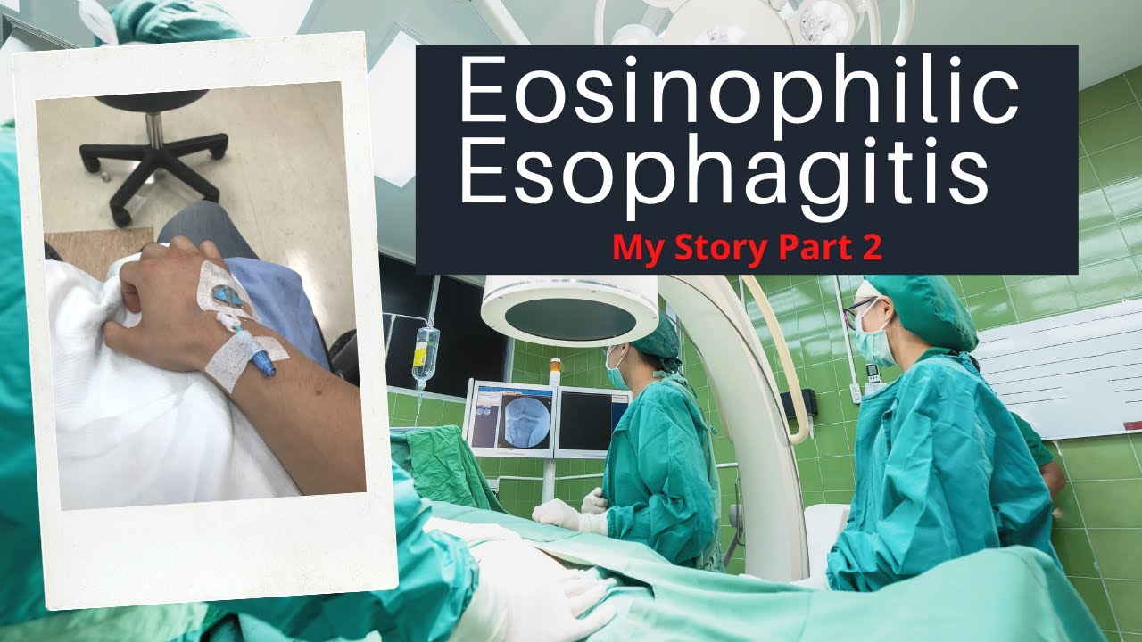I Was Sedated At The Hospital...BUT AWAKE DURING! Eosinophilic Esophagitis (EoE) My Story Part 2!