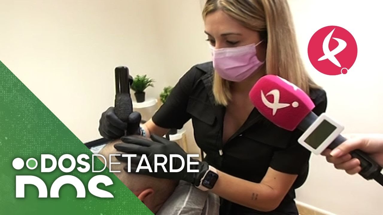 La micropigmentación, una técnica para disimular la calvicie sin pasar por quirófano | Dos de tarde