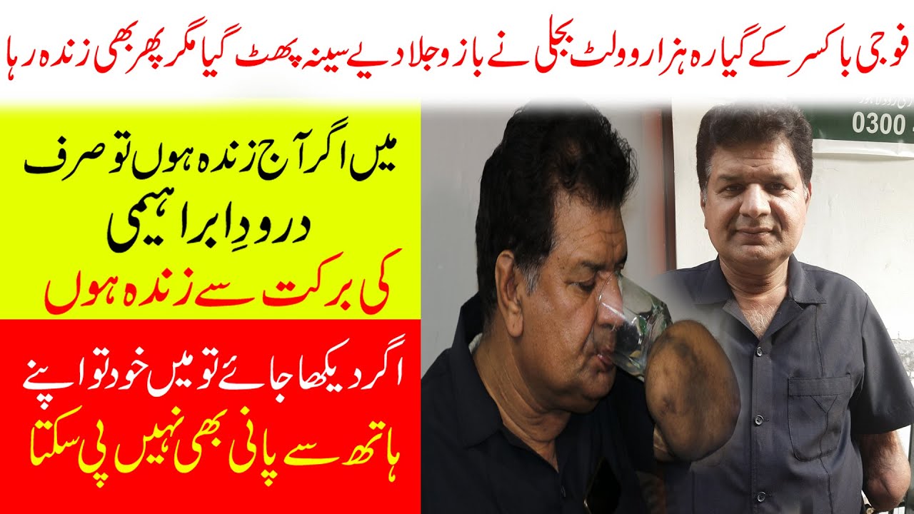 11000 VOLT LIGTH BURNED BOTH ARMS OF ARMY BEST BOXER | BABAR BAIG GUJRATI l AB HD TV |  LATEST VIDEO