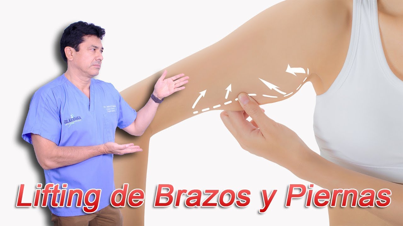 ¿Qué es el Lifting de Brazos y el Lifting de Piernas?