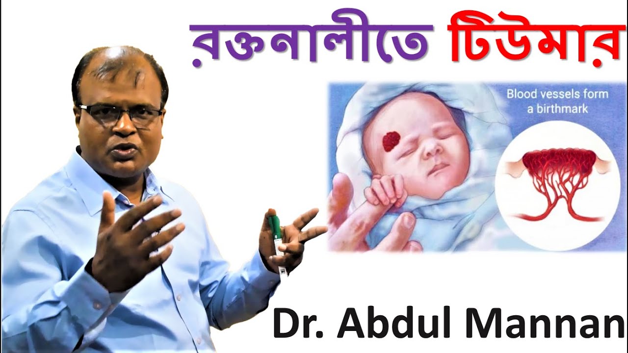 রক্তনালীতে টিউমার | হেমানজিওমা - Hemangioma | Bangla health tips | Dr. Abdul Mannan
