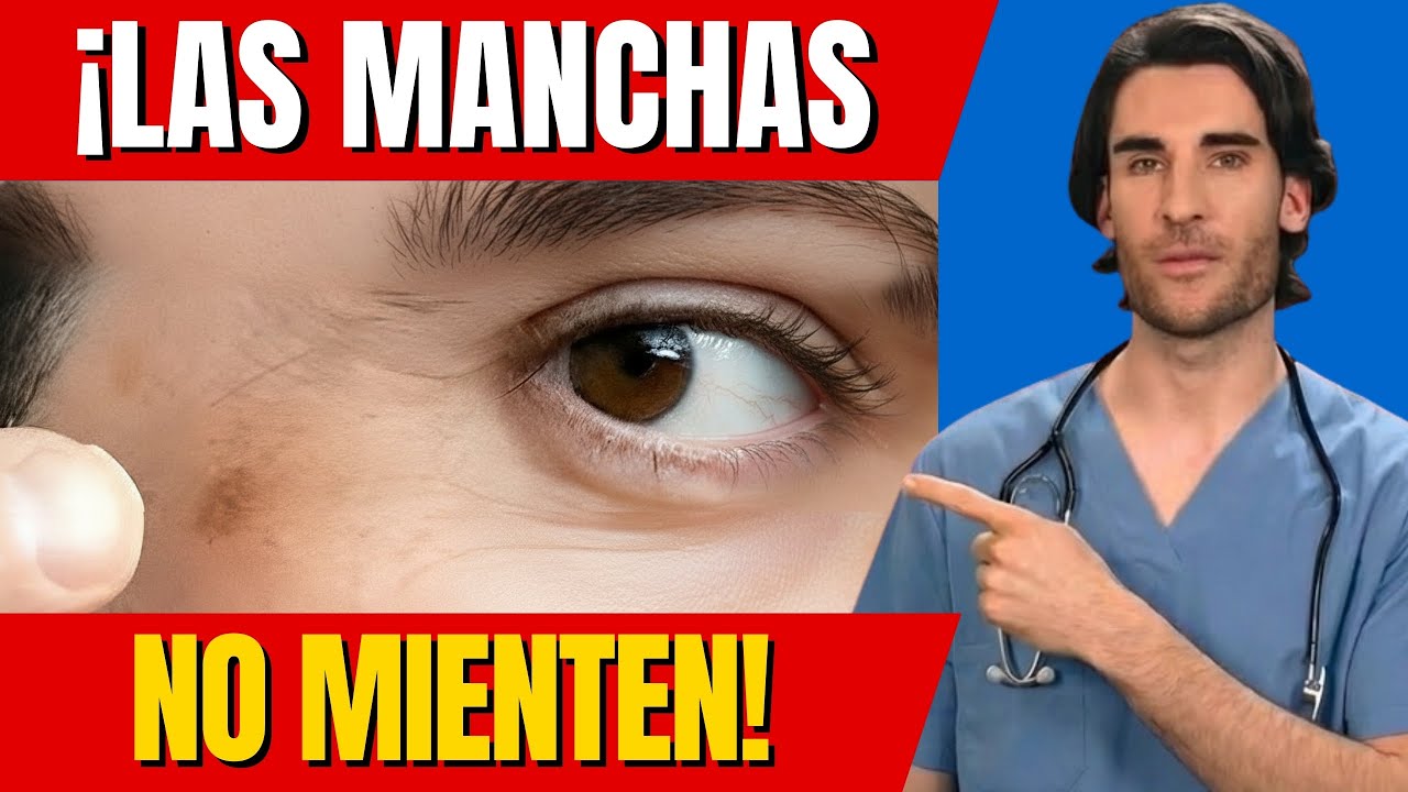 5 Enfermedades Que Se Manifiestan Por las ¿MANCHAS EN TU PIEL? | Dr. Emilio