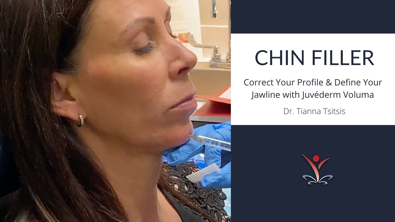 Contour Your Chin & Jawline with Filler