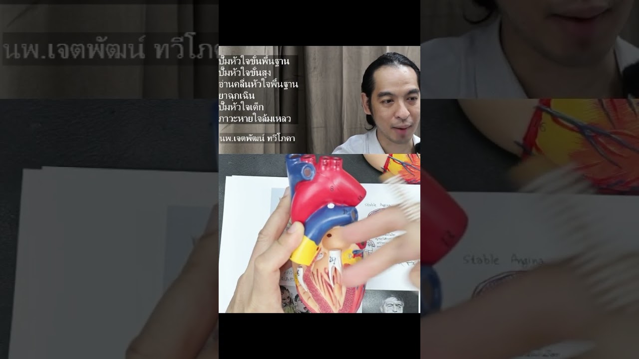 ทบทวนปั๊มหัวใจ