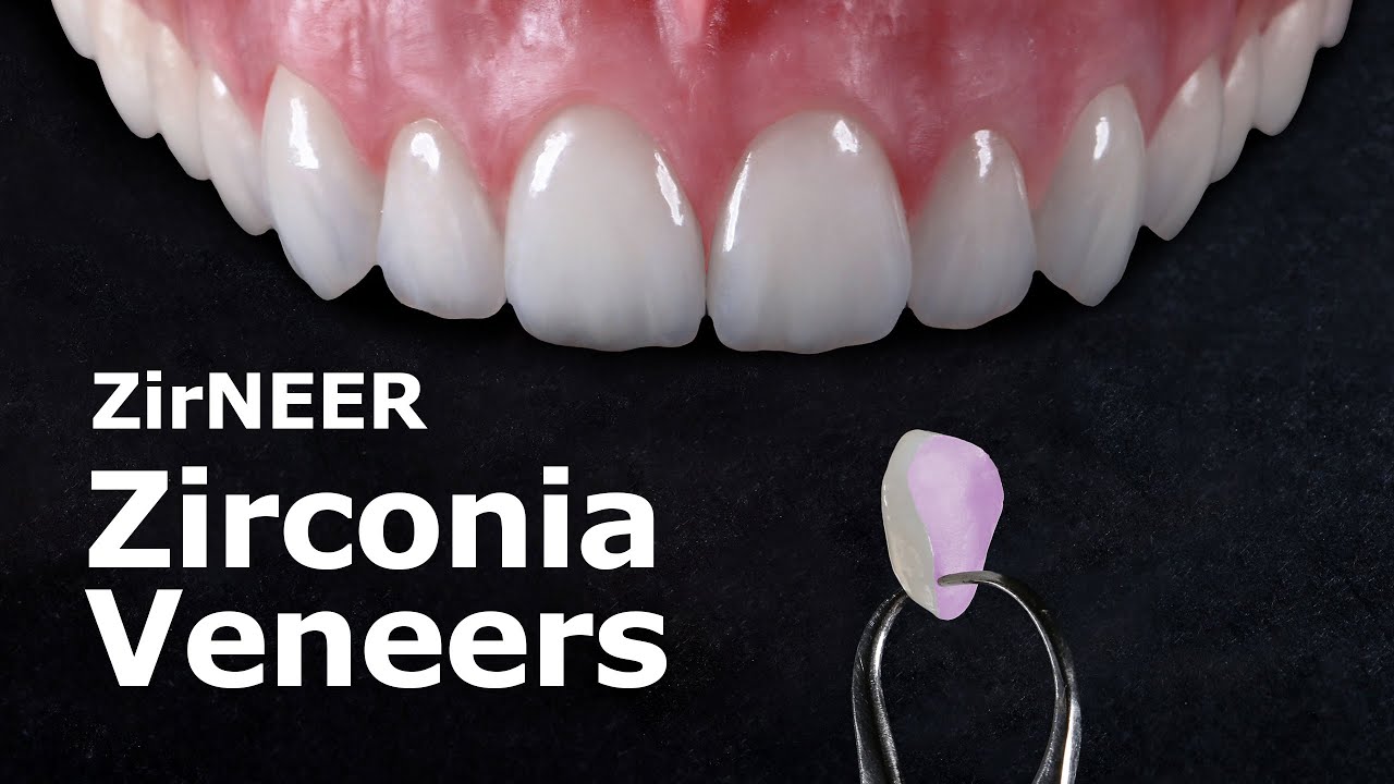 ZirNEER | Zirconia Veneers | Robust Bonding with Minimal Invasive Approach