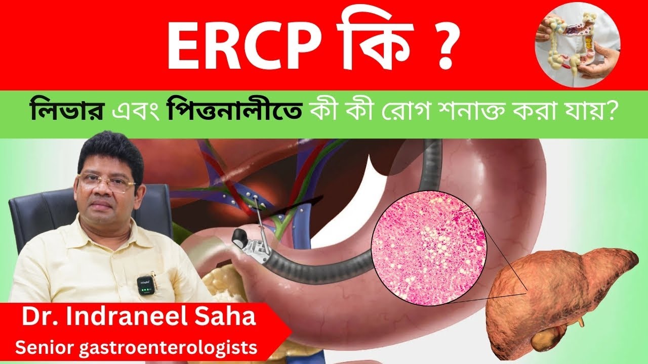 What is ERCP ? -  Dr  Indranil Saha | Best Gastroenterologist in Kolkata