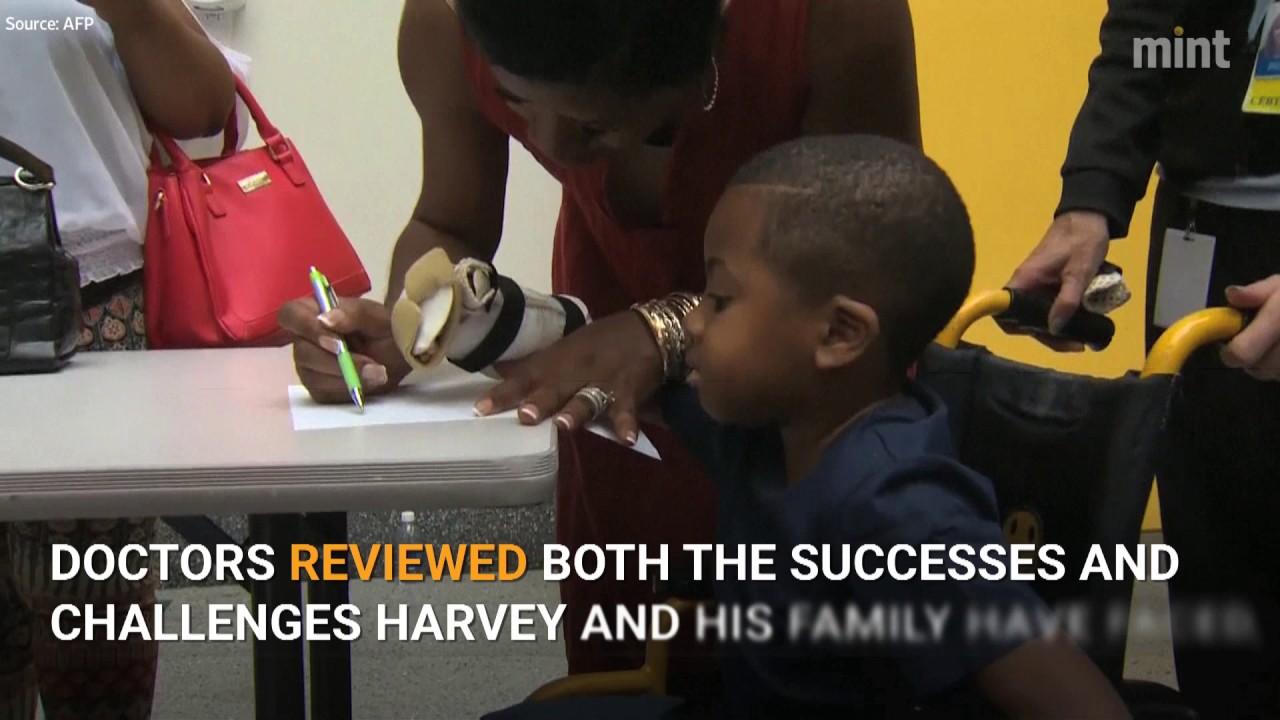 World&rsquo;s 1st double hand transplant a success